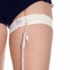 Conveen Catheter Retaining Strap - Pack of 2