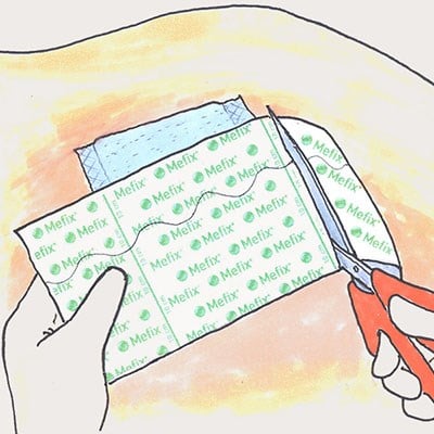 Molnlycke  Mefix Fabric Tape