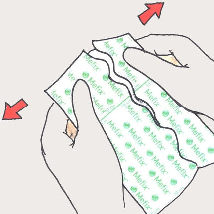 Molnlycke  Mefix Fabric Tape