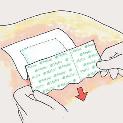 Molnlycke  Mefix Fabric Tape